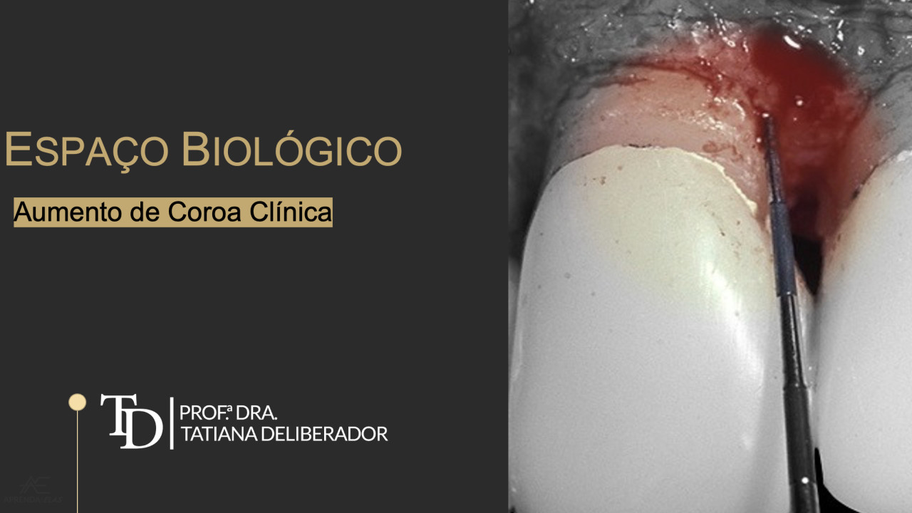 Espaço biológico e Aumento de Coroa Clínica.