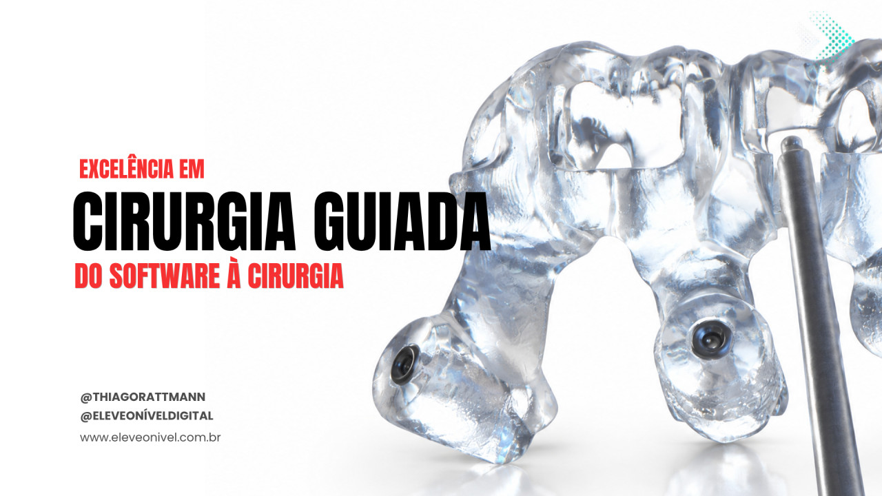 Excelência em Cirurgia Guiada - Do desenho à cirurgia